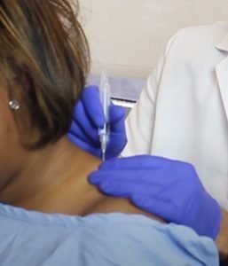 woman receiving a trigger point injection in her deltoid