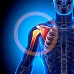 Shoulder Pain